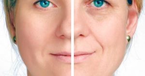 mejoras de la piel del rostro